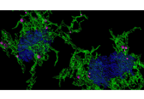 /sites/shcommonassets/Assets/Tomorrow%27s%20Medicine/20210521_DukeNUSAlzheimers.png