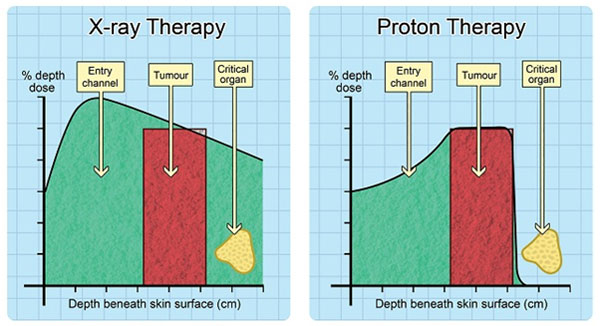 NCCS bringing in proton beam therapy for safer cancer treatment