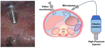  Schematic of PIPAC setup - NCCS