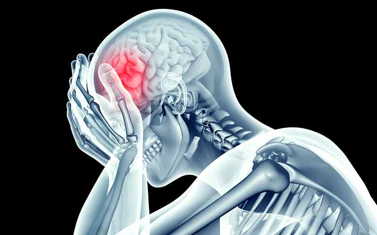 Mini Stroke: Would You Know If You Had An Attack?