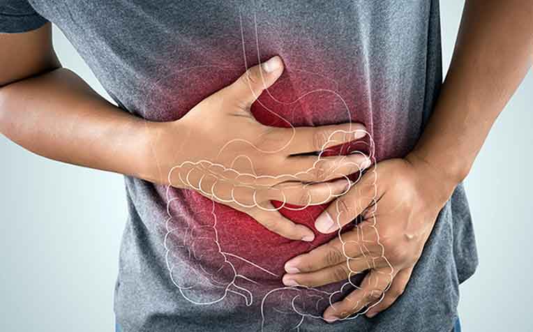 IBS: How FODMAP Foods Play a Part