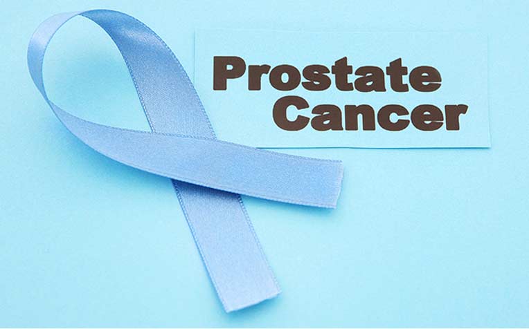 Prostate Cancer: Why is It Hard to Detect Early?