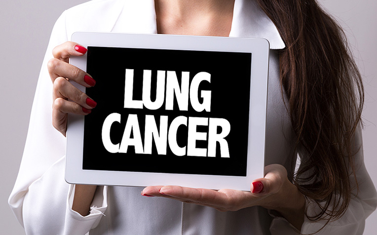 Why Non-Smoking Asian Women Get Lung Cancer