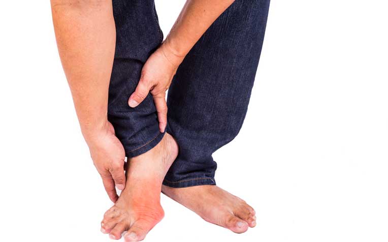 Gout: Is There a Cure?