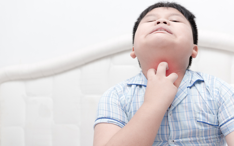 Symptoms of Food Allergies in Children