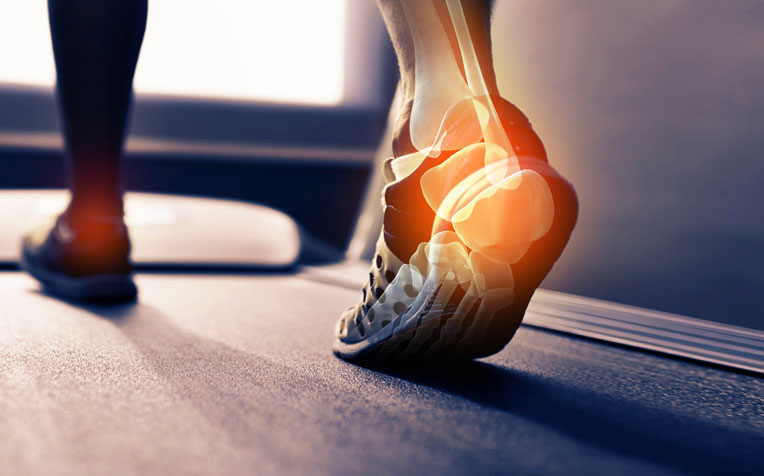 How to Treat Common Running Injuries: Thigh and Heel Pain
