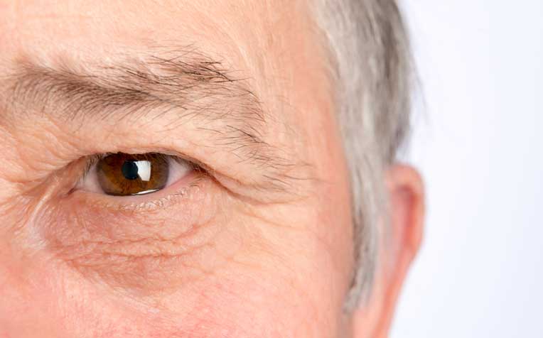 Age-Related Macular Degeneration: What You Need to Know