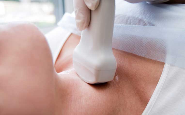 Hypothyroidism (Undereactive Thyroid): Causes and Symptoms