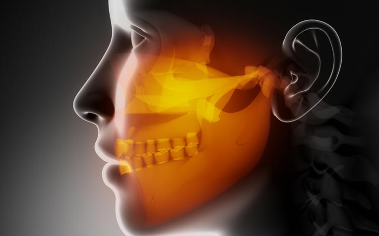 Jaw Abnormality and Jaw Surgery - Doctor Q&A