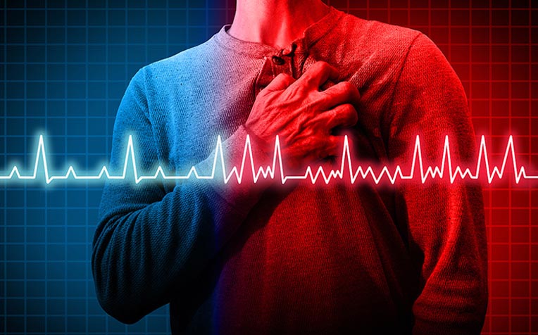 Arrhythmia (Irregular Heartbeat): How It Causes Sudden Cardiac Arrest