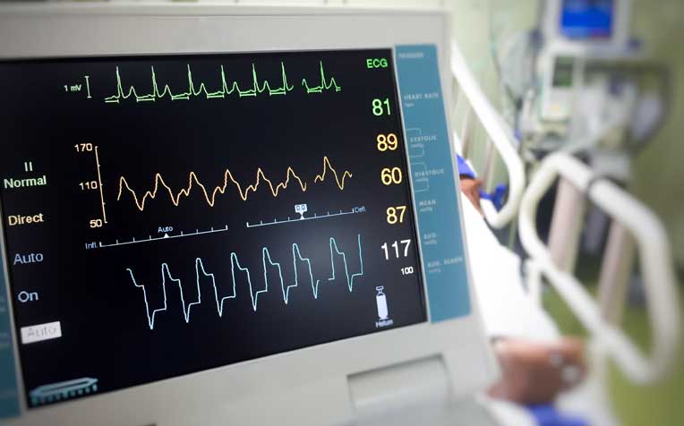 ​Cardiac Tests: Electrocardiogram and Exercise Stress Test