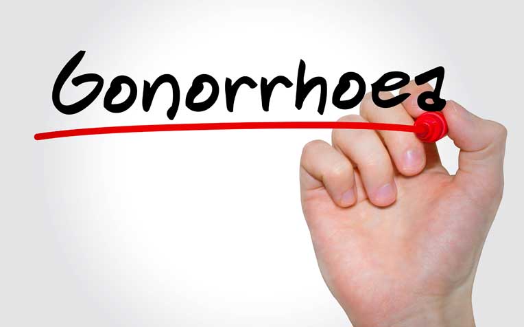 Gonorrhoea: Causes, Symptoms, Treatment