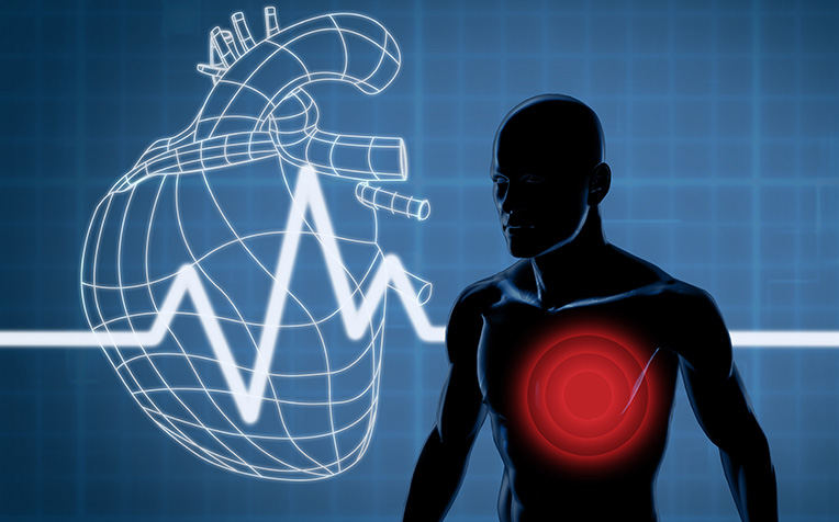 Atrial Fibrillation: What are the risk factors?