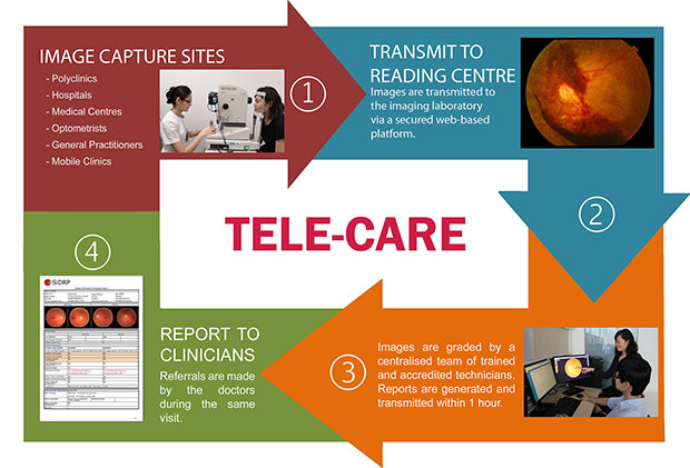 Singapore Integrated Diabetic Retinopathy Programme (SiDRP)