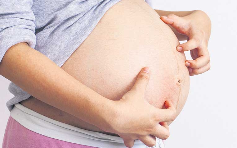 /sites/shcommonassets/Assets/News/skin-woes-during-pregnancy.jpg