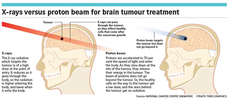 Proton Beam Therapy System to Treat Cancer With Less Harm