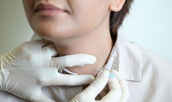 Thyroid disorders can be managed with diet and exercise - Singapore General Hospital